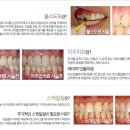 대전에 임플란트, 교정 잘하는 치과를 추천해 드려요 EL 이미지