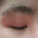 디플러스 | 성인 아토피 로션 샤블 디플러스 내돈내산 후기