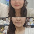 웨딩관리로 추천하는 평택피부관리 영스킨케어 시그니처 여배우 얼굴관리 탄력경락 리프팅 후기
