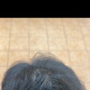 "진해에서 사상까지 카풀해서 가요" 창원 탈모인들이 상륙한 부산 르네시떼 미용실, 토탈탈모교정펌의 기적 [가야개금당감범전범천부암부전양정 이미지