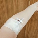 복강식품 | 담석증으로 담낭절제술 받은 후기｜증상, 수술비·실손보험·식단 총정리