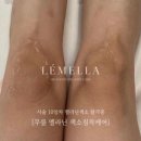 출장바디케어 이미지