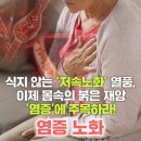 박병순 | [서평] 노화의 진짜 원인 공개! 피부과 전문의 박병순의 혈액으로 젊어지는 4단계 루틴, 염증노화