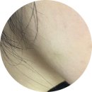 오라클피부과의원(화곡점) | 예민한 피부 추천! 스킨보톡스 2회 경험담 [경기광주 오라클피부과]