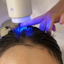 건강한다나약국 | 산본 두피관리 추천 도노포레스타 산본점 두피 개인 맞춤관리