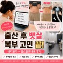 네오 - 강남구 강남대로126길 24-1 | 명동역피부과 바디온다 엠스컬프네오 후기, 출산 후 복부 고민으로 다녀왔어요