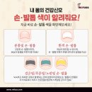 나도손톱 레푸스 개봉점 네이버블로그