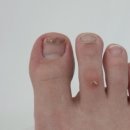 레푸스&아트포레 이미지