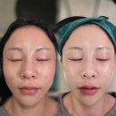 유니뷰티 | 노원 스킨플래닝 후기-유니컬 뷰티랩 노원점 -화장 밀림 해결된 리얼후기