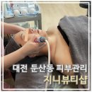 둔산동피부관리 "지니뷰티샵" 홍조 관리 후기