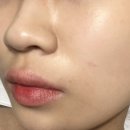 신논현피부관리 [엔트왁싱랩] 수분관리 솔직후기 / 논현동왁싱, 신논현왁싱, 강남 피부관리, 강남...
