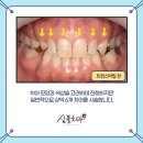 트윈치과기공소 이미지