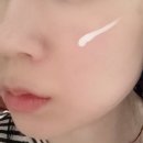 디온약국 | 피부과 멍, 시술 후 붉은기엔 약국비타민k크림! 디에스 올인원K크림 솔직 리뷰