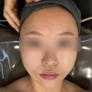 광주 봉선동 피부샵 페이스 경락 후기 : 세경스킨케어