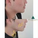 쎄리스킨케어 | 충주리프팅no.1)충주페이스리프팅 바디리프팅 충주원쎄라 다이어트 충주피부관리