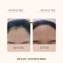 권헤어라인