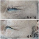 계산동 피부관리 바디관리 예쁘미 스킨 아로마테라피 관리!