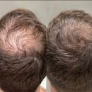 봄철 나의 두피 및 피부관리법 | 60대, 이제는 나를 돌보는 시간 – 설 연휴 피부·두피 관리 솔직 후기