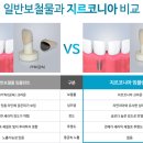 허브치과 네이버블로그