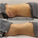 텃밭 수완점 | 광주 수완지구 신부관리, 다이어트 시작 뼈팔, 뼈복부 도전하기