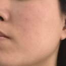 본뷰티 | 예신 피부관리 시작 마포피부관리 라르본뷰티 맞춤관리 후기
