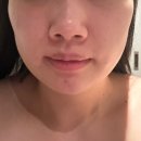 남부순환로181길 | [쁘띠팰리스 신림점] 신림피부관리 아이돌 윤곽관리로 얼굴라인 달라진 후기