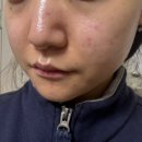 미라클피부관리실가경 | [청주] 가경동피부관리 '미라클피부관리실' 가경점 솔직후기