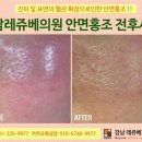 강남레쥬베의원 네이버블로그