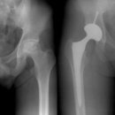 현대정형외과 이미지