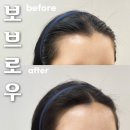 헤어보브 | 청주 헤어라인 잘하는 곳::보브로우 성안길 반영구 후기