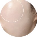 싱그린 | [예소리 문씰] 문씰 싱그린 퓨어 포어 패드 후기 / 예소리 문씰패드 / 문씰 화장품 / 문씰 패드 후기...