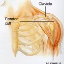 Shoulder Pain 이미지