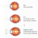 이노티안경원 이미지