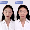 성신한의원 | 💆🏻‍♀️ 한혜진이 선택한 얼굴침?! 성신여대 글로리한의원 시술 정보 총정리 ✨