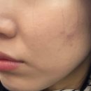 대치예스약국 네이버블로그