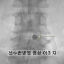 잠실의료기 이미지