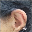 포낙보청기 강동센터 이미지