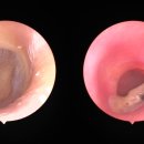 한미보청기 이미지