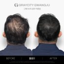 하루두피 광주첨단신창점 | 광주첨단두피문신 대표원장이 직접 상담 및 시술하는 그레이시티광주점 후기