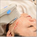 센텀7로 | 센텀울쎄라 후기 – 2개월간의 리프팅 변화 리얼 체험기