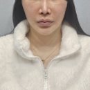 젤성형외과의원 이미지