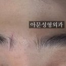 아문성형외과의원 이미지