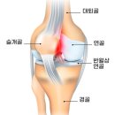 C-X GYM | [양정헬스 | 양정PT] 러닝 후 무릎 앞쪽 통증 원인