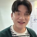 주-004-한국의원2 | 남자 리쥬란힐러 후기 | 내돈내산 30대 인플루언서의 진짜 후기 (라라플랜의원 잠실새내)