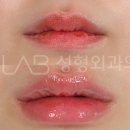 시그니처성형외과의원 이미지