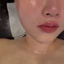 오투성형외과 | 동래피부관리 : 더노블메디센터