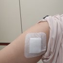 [내돈내산 광주 문신제거 3회차 후기] 남구 병원으로 옮기다