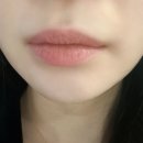 제31사단공병대대 | 부산 마린시티 미엘르 에스테틱 필러없는 건강한 입술관리 립퍼밍 추천 후기