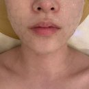 러블리현 | 중요한날 피부가 반들반들해지고 싶다면 러블리현 mts관리 후기