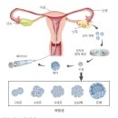 아이봄약국 | 신선 1차 종결ㅣ총 비용 정리ㅣ3일 배양 배아, 5일 배양 배아 차이ㅣ동결이식, 신선이식 차이ㅣ후기 #4